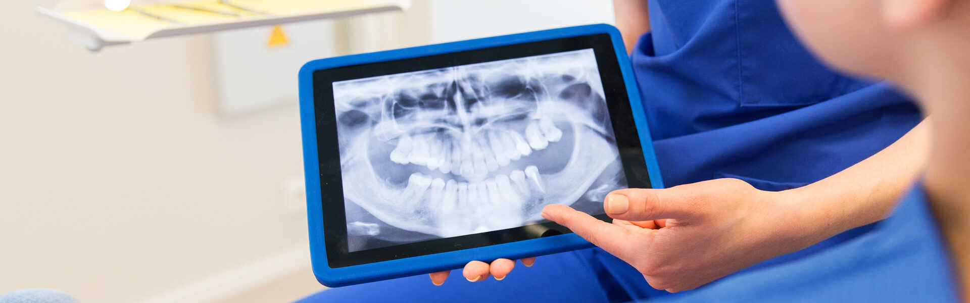 Digital X-Rays
